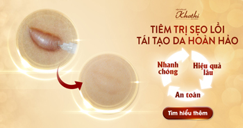 Điều trị sẹo lồi